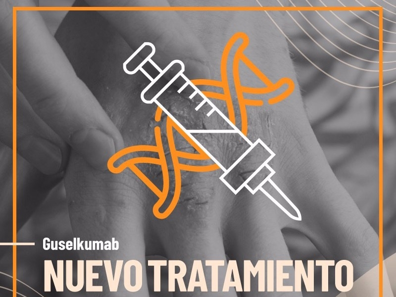 Guselkumab nuevo tratamiento para la psoriasis ya aprobado en Argentina
