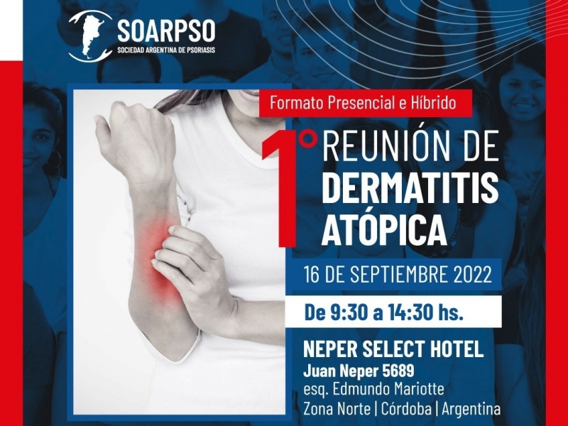 1er Reunión de Dermatitis Atópica en Córdoba